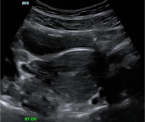 Introduction To Bedside Ultrasound