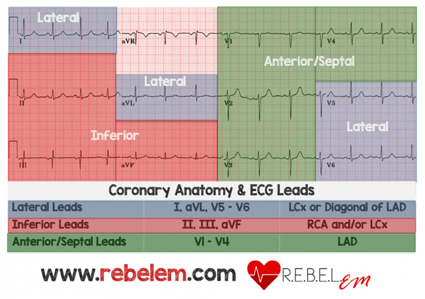 STEMI - Electrocardiogram - M3 Curriculum | SAEM