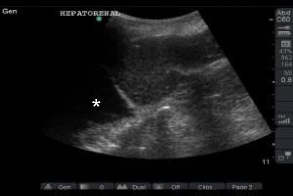 Introduction To Bedside Ultrasound