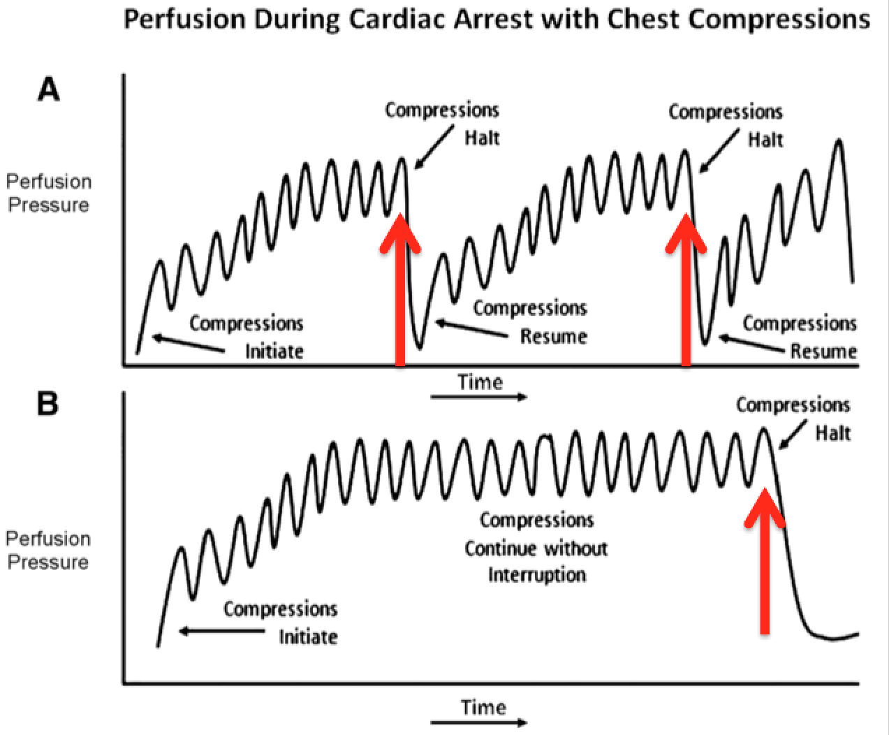 cardiac-arrest